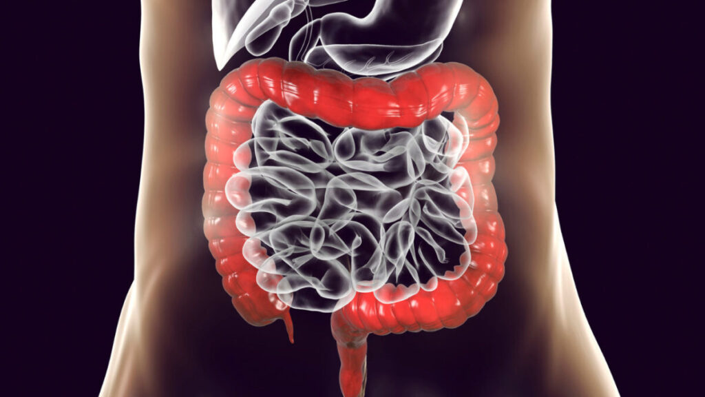 Intestino grosso saudável Intestino grosso saudável