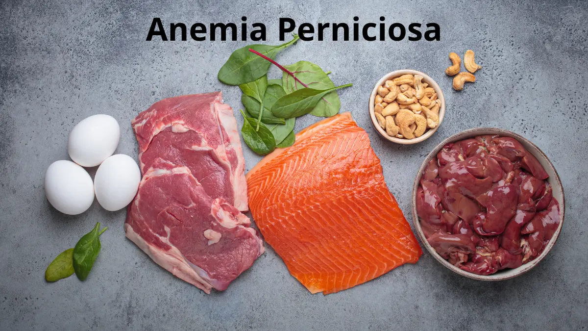 Anemia Perniciosa Anemia Perniciosa