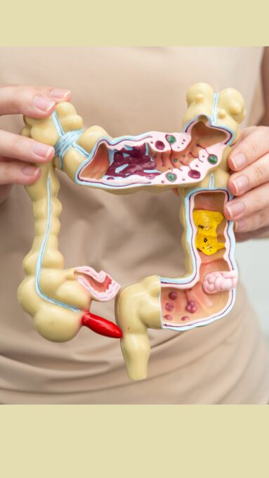 Permeabilidade Intestinal 1