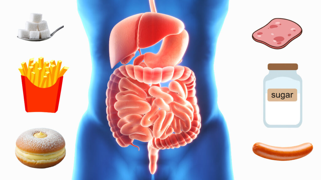 Resistência a Insulina Resistência a Insulina